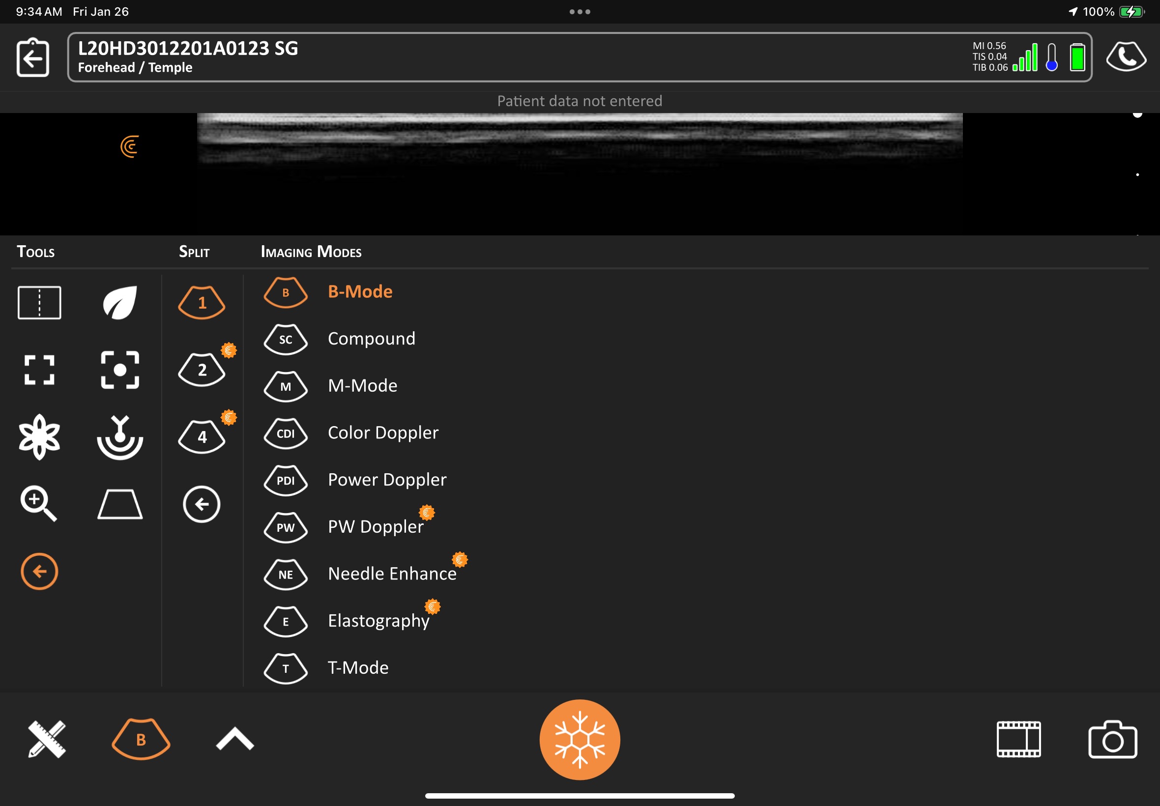 Clarius T Mode - Activación del modo de visualización avanzada de tejidos